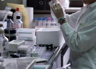 Leucemia mieloide cronica, dati confermano efficacia asciminib