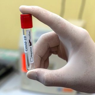Coronavirus in Piemonte: 64 i decessi oggi, altri 1136 i pazienti guariti