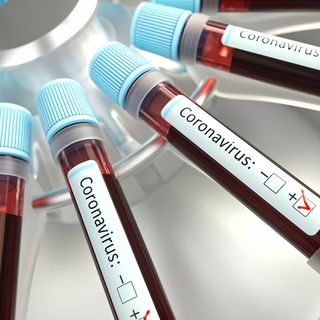 Quasi 100 morti per il coronavirus in Piemonte, ma continuano a calare terapie intensive e ricoveri