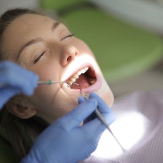 Quanti tipi di impianti dentali esistono? La guida completa per il paziente