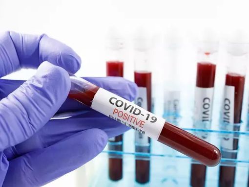 coronavirus - foto di repertorio