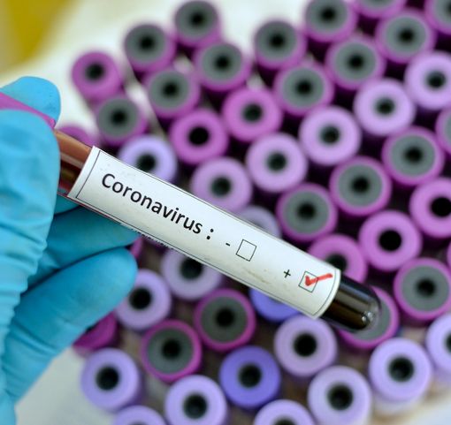 Coronavirus, altri 173 nuovi casi in Piemonte. Crescono sia i ricoveri in ospedale che quelli in terapia intensiva