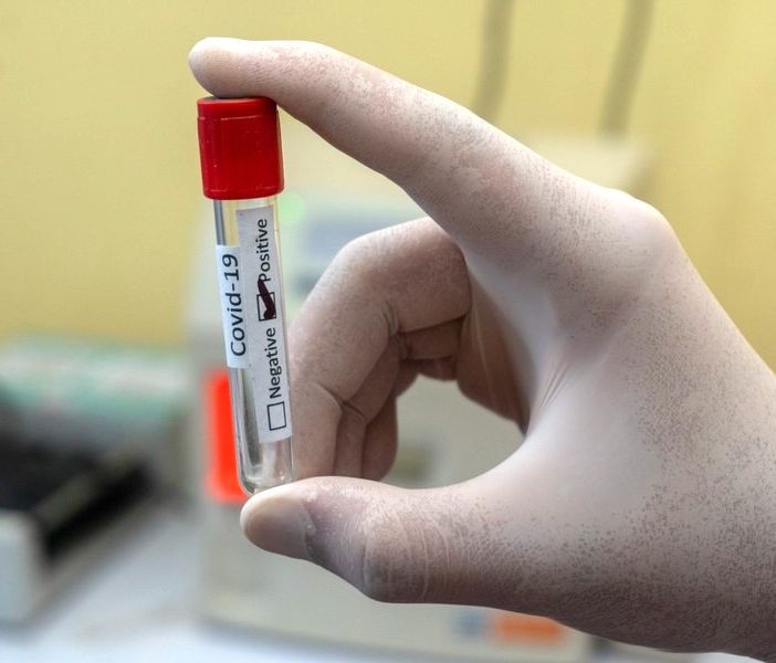 Coronavirus in Piemonte: 64 i decessi oggi, altri 1136 i pazienti guariti