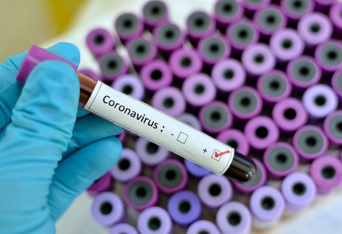 Coronavirus, altri 173 nuovi casi in Piemonte. Crescono sia i ricoveri in ospedale che quelli in terapia intensiva