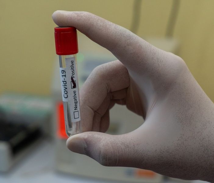 Coronavirus, opposizioni all'attacco in Regione: &quot;Tamponi al palo, dobbiamo riaprire l'unità di crisi. Il Piemonte mostra tutta la sua fragilità&quot;