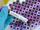 Coronavirus, altri 173 nuovi casi in Piemonte. Crescono sia i ricoveri in ospedale che quelli in terapia intensiva