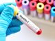 Asl To3, sabato 20 aprile nuova giornata di screening gratuito per HCV-Epatite C