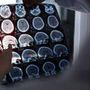 Nuove molecole e bersagli, così si evolve la terapia contro l'Alzheimer: il punto