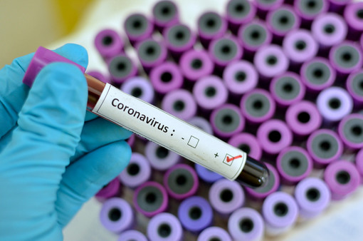 Coronavirus, sfonda quota mille il numero dei nuovi positivi in Piemonte, 595 solo in provincia di Torino