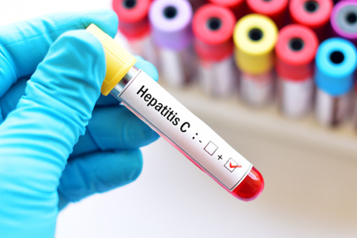 Asl To3, sabato 20 aprile nuova giornata di screening gratuito per HCV-Epatite C