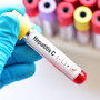 Asl To3, sabato 20 aprile nuova giornata di screening gratuito per HCV-Epatite C
