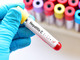screening epatite c