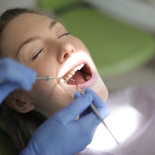Quanti tipi di impianti dentali esistono? La guida completa per il paziente