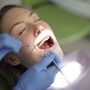 Quanti tipi di impianti dentali esistono? La guida completa per il paziente