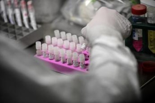 Rischio Long Covid, scoperta variante genetica che lo aumenta del 60%