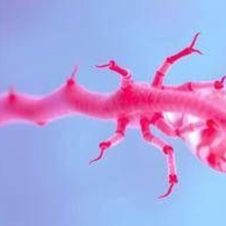 Miastenia, in Sardegna su mille pazienti stimati solo metà nel registro