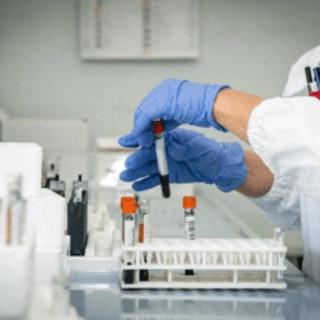 Alzheimer, allo studio nuovo test del sangue per diagnosi precoce