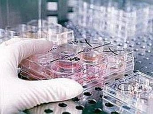 Fecondazione, non solo endometriosi: il nuovo protocllo che combatte l'adenomiosi