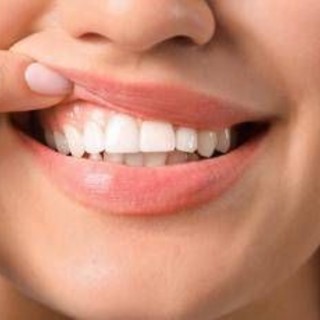Denti a rischio tra i giovani, Sidp: "Il 36% della Gen Z ha gengive che sanguinano" Denti a rischio tra i giovani, Sidp: "Il 36% della Gen Z ha gengive che sanguinano"