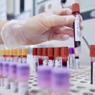 Hiv, dalla Sicilia il modello per estendere terapie long acting Hiv, dalla Sicilia il modello per estendere terapie long acting
