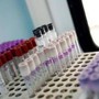 Mielofibrosi, speranze da nuovo farmaco che limita l'anemia in 2 pazienti su 3
