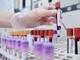 Dal microbiota una speranza contro l'epilessia resistente, lo studio italiano Dal microbiota una speranza contro l'epilessia resistente, lo studio italiano
