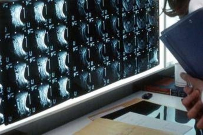 Oltre 500 malattie rare delle ossa, esperti: "Investire in prevenzione e diagnosi" Oltre 500 malattie rare delle ossa, esperti: "Investire in prevenzione e diagnosi"