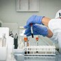 Mielofibrosi, ematologo: &quot;Con uso precoce momelotinib maggiore sopravvivenza&quot;