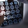 Rallentare l'Alzheimer con il litio, scoperta la 'scintilla' che innesca la patologia?
