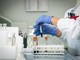 Mielofibrosi, ematologo: &quot;Con uso precoce momelotinib maggiore sopravvivenza&quot;