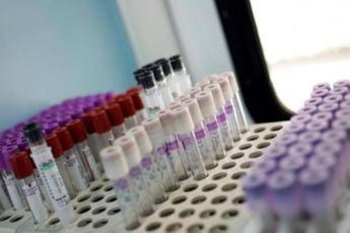 Mielofibrosi, speranze da nuovo farmaco che limita l'anemia in 2 pazienti su 3