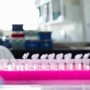 Milano, focolaio di tubercolosi all'Istituto di Medicina legale: 8 casi conclamati e 7 positivi. Indagini sull'origine del contagio Milano, focolaio di tubercolosi all'Istituto di Medicina legale: 8 casi conclamati e 7 positivi. Indagini sull'origine del contagio