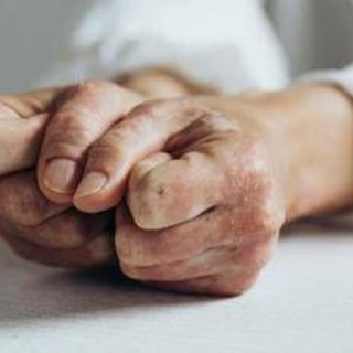 Lo studio, inibitore Il-23 riduce segni e sintomi artrite psoriasica attiva