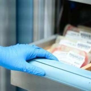 Leucemia mieloide cronica, esperto 'asciminib per bisogni clinici irrisolti'