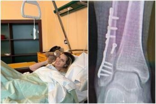 Thais Wiggers, operazione alla caviglia dopo incidente: "Comincio anno con un piede bionico"