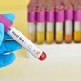 West Nile, Iss: &quot;10 casi da inizio anno, 7 in provincia di Latina&quot;