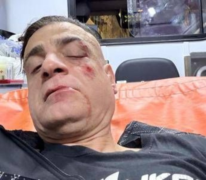 Cicalone, lo youtuber aggredito in metro a Roma: "Infami veri" Cicalone, lo youtuber aggredito in metro a Roma: "Infami veri"